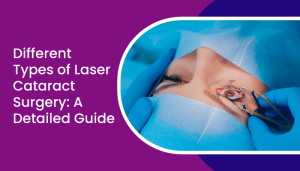 Different Types of Laser Cataract Surgery - A Detailed Guide