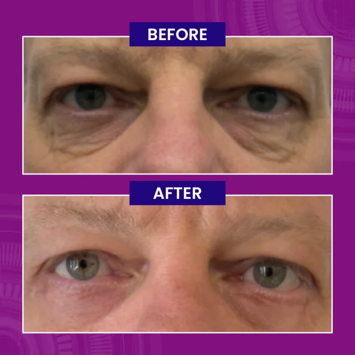 Paragon Clinic - Before After Images-01 Paragon Clinic Before After Images 01