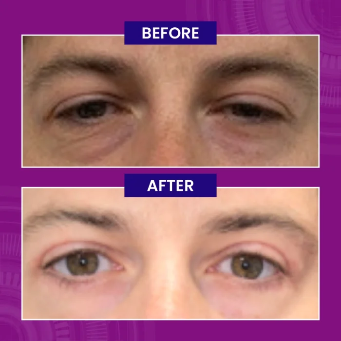 Paragon Clinic - Before After Images-02 Paragon Clinic Before After Images 02