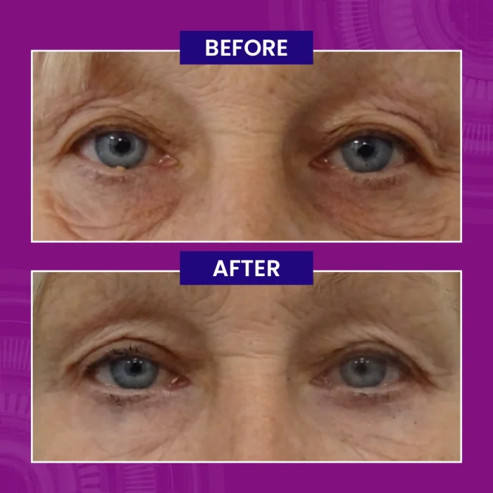 Paragon Clinic - Before After Images-03 Paragon Clinic Before After Images 03