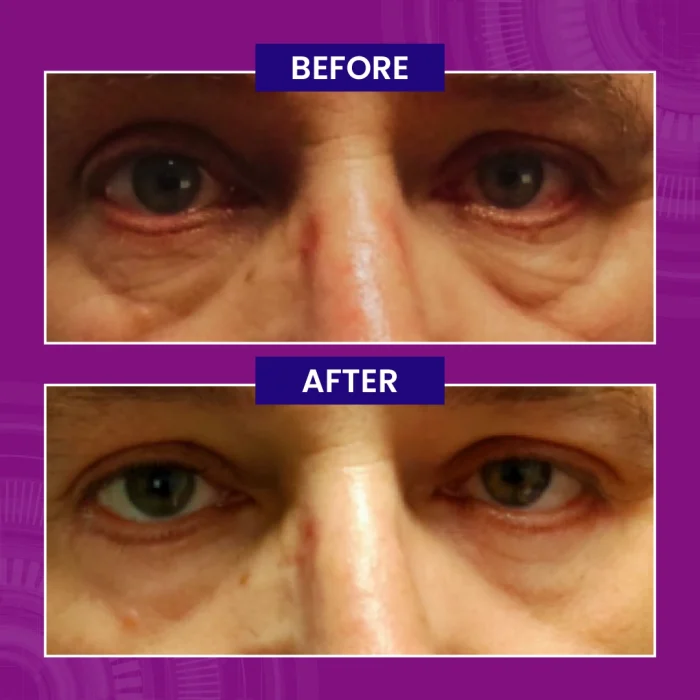 Paragon Clinic - Before After Images-04 Paragon Clinic Before After Images 04