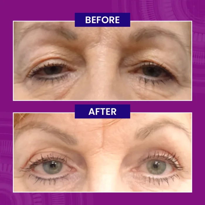 Paragon Clinic - Before After Images-05 Paragon Clinic Before After Images 05