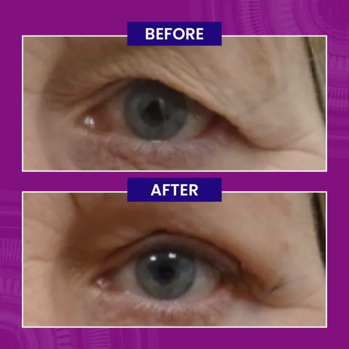 Paragon Clinic - Before After Images-06 Paragon Clinic Before After Images 06